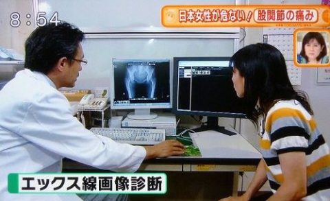 “マンコ”の形がはっきり分かるTVで放送されてしまったハプニング映像…ヒェェーｗｗｗ（画像あり）・28枚目